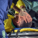 Neymar Lesiona Joelho: Cirurgia e Recuperação