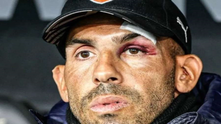 Tévez Supera Traumatismo e Lidera Independiente